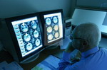 Neurosurgery